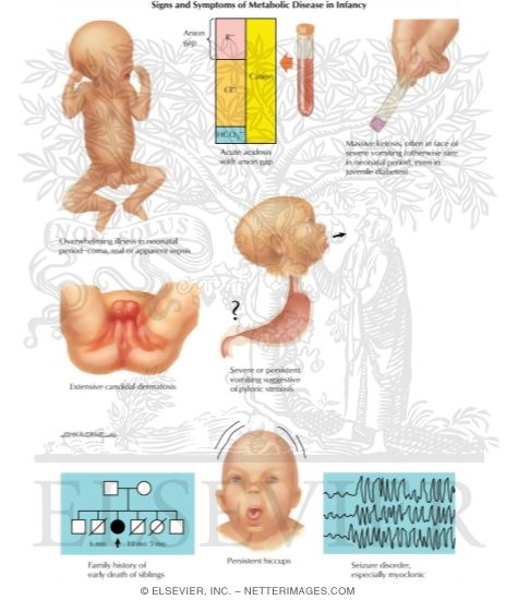 Watermarked preview of labeled image: Birth Defects: Signs and Symptoms of Metabolic Disease In Infancy