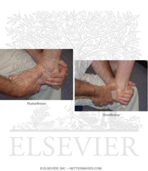 Watermarked preview of labeled image: Impingement Sign