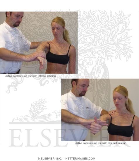 Watermarked preview of labeled image: Active Compression Test