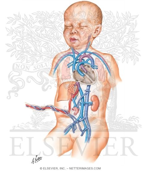 Fetal Circulation