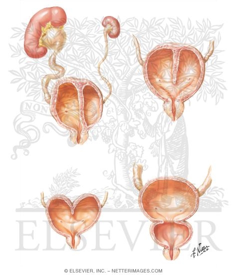 Bladder Anomalies