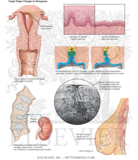 Watermarked preview of labeled image: Target Organ Changes in Menopause