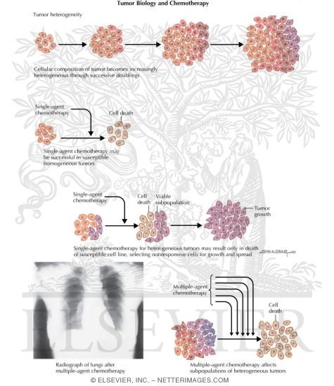 Watermarked preview of labeled image: Tumor Biology and Chemotherapy