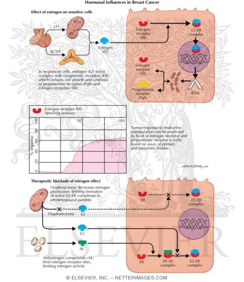 Watermarked preview of labeled image: Hormonal Influences in Breast Cancer