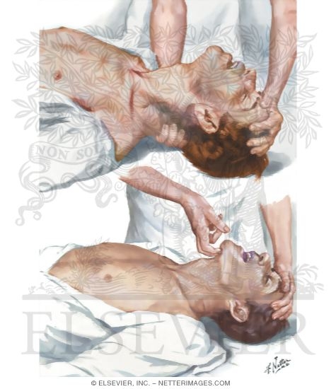 Watermarked preview of unlabeled image: Cardiopulmonary Resuscitation (CPR): Airway