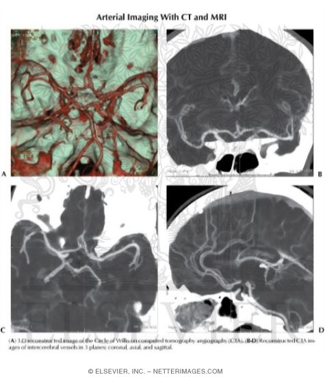 Watermarked preview of labeled image: Arterial Imaging With CT and MRI