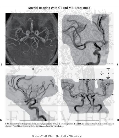 Watermarked preview of labeled image: Arterial Imaging With CT and MRI