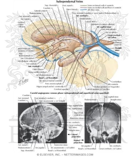 Watermarked preview of labeled image: Subependymal Veins of Brain