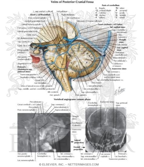 Watermarked preview of labeled image: Veins of Posterior Cranial Fossa