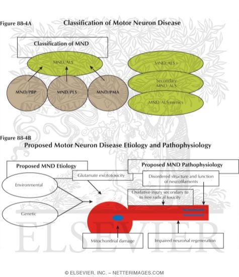 Motor Neuron Disease: Schematic