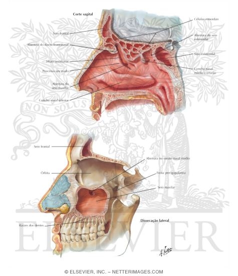 Paranasal Sinuses
