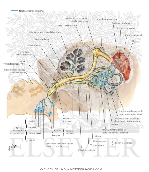 Watermarked preview of labeled image: Vestibulocochlear Nerve (VIII)