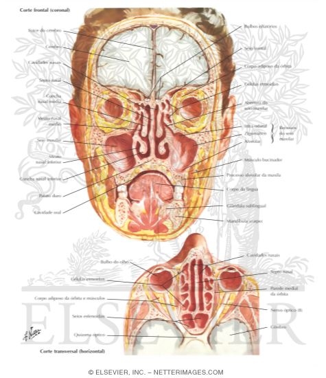 Watermarked preview of labeled image: Paranasal Sinuses
Nasal Allergy