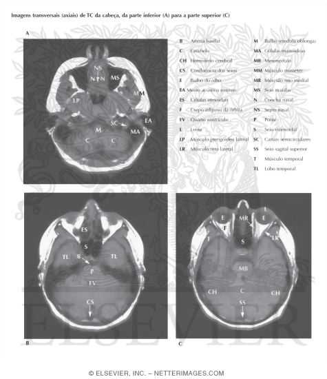 Watermarked preview of labeled image: Head Scans: Axial CT Images
