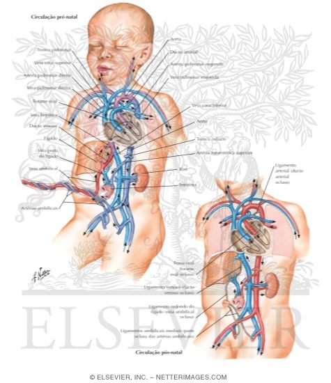 Watermarked preview of labeled image: Fetal Circulation