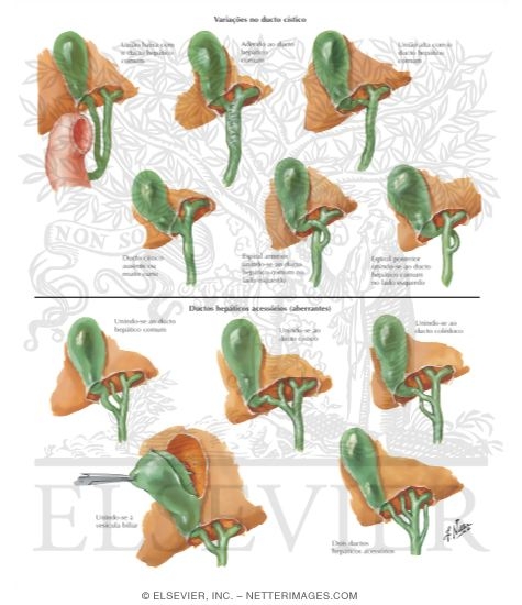 Watermarked preview of labeled image: Variations In Cystic and Hepatic Ducts