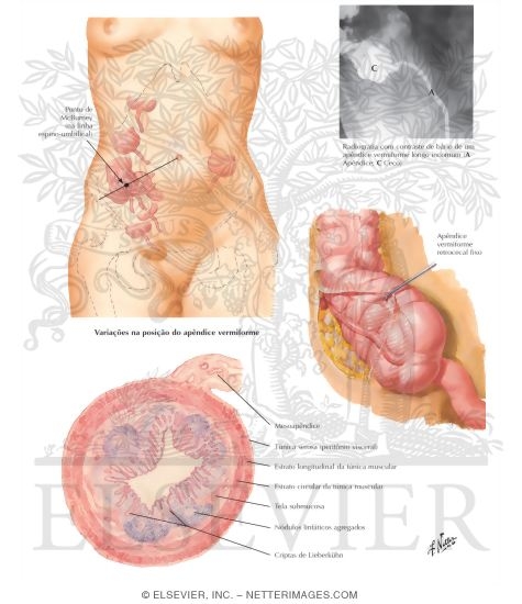 (Vermiform) Appendix
Appendix Vermiformis