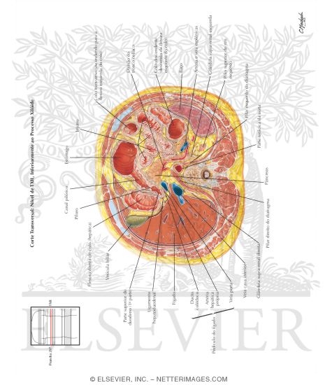 Watermarked preview of labeled image: Abdomen: Pylorus and Body of Pancreas