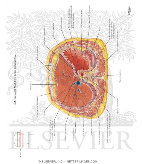 Watermarked preview of labeled image: Abdomen: Esophagogastric Junction