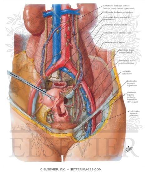 Lymph Vessels and Nodes of Pelvis and Genitalia: Female
Lymphatic Drainage II - Internal Genitalia