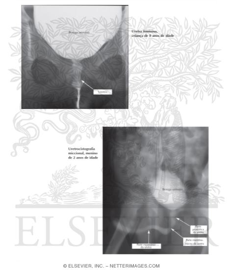 Watermarked preview of labeled image: Male and Female Cystourethrograms