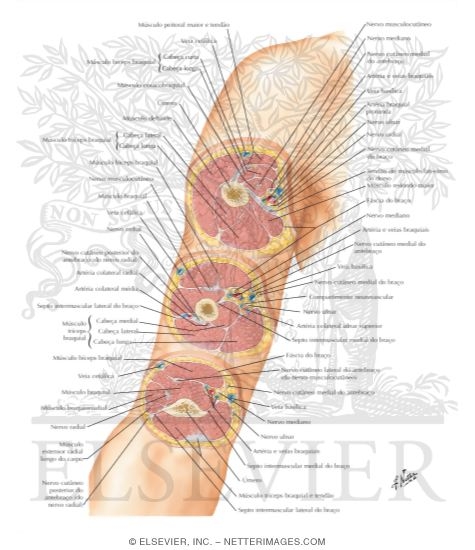 Watermarked preview of labeled image: Cross-Sectional Anatomy of Upper Arm 