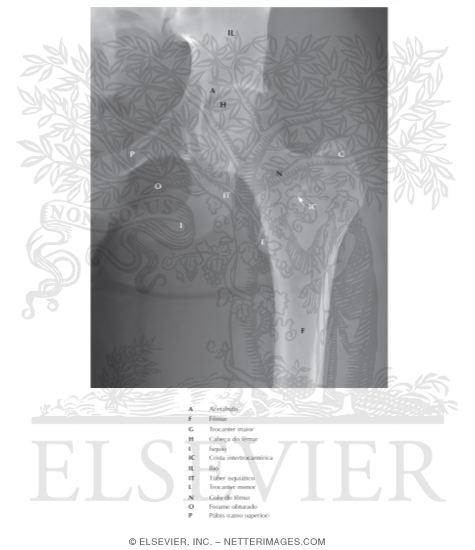 Watermarked preview of labeled image: Hip Joint: Anteroposterior Radiograph