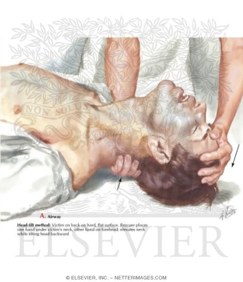 Watermarked preview of labeled image: Opening Airway; Head Tilt