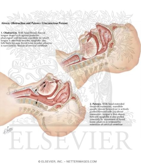 Watermarked preview of labeled image: Anatomy of Opening Airway
