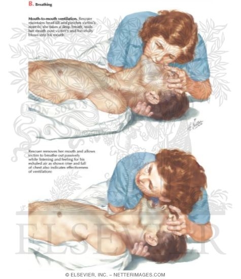 Watermarked preview of labeled image: Mouth-To-Mouth Ventilation