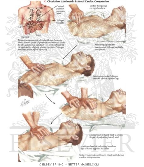 Watermarked preview of labeled image: Placement of Hands