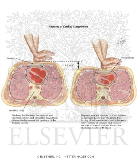 Watermarked preview of labeled image: Anatomy of Cardiac Compression