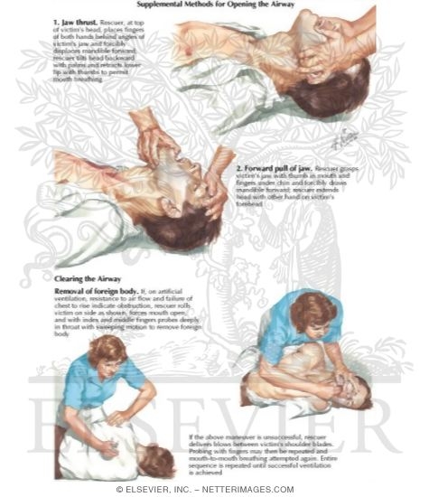 Watermarked preview of labeled image: Supplemental Methods for Airway