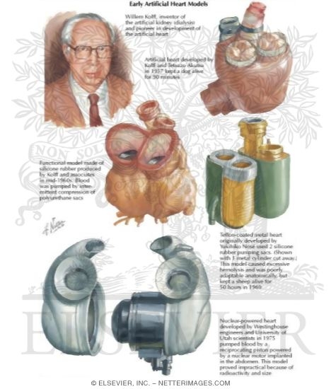 Watermarked preview of labeled image: Earlier Artificial Heart Models