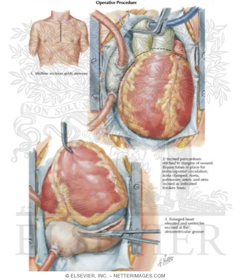 Watermarked preview of labeled image: Operative Procedure