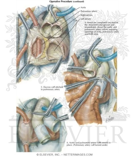 Watermarked preview of labeled image: Operative Procedure