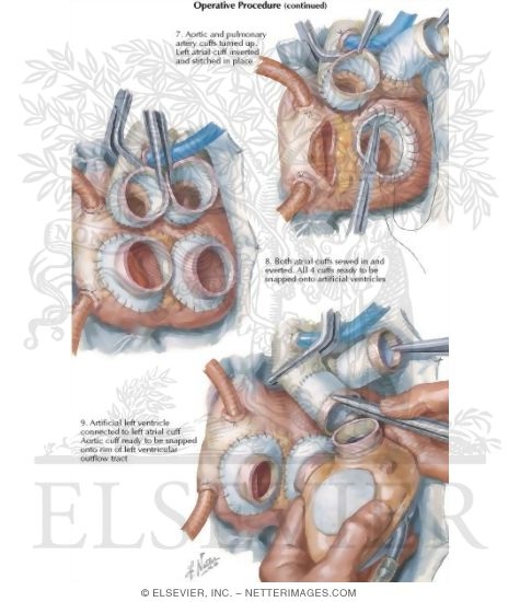 Watermarked preview of labeled image: Operative Procedure