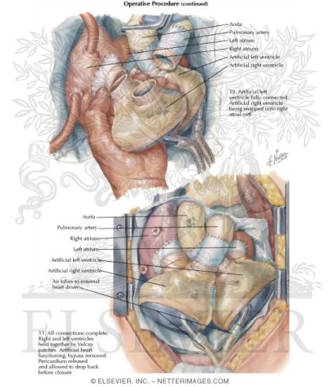 Watermarked preview of labeled image: Operative Procedure