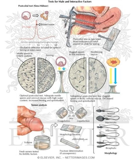 Watermarked preview of labeled image: Tests for Male and Interactive Factors