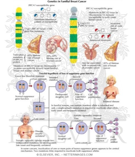 Watermarked preview of labeled image: Genetics in Familial Breast Cancer