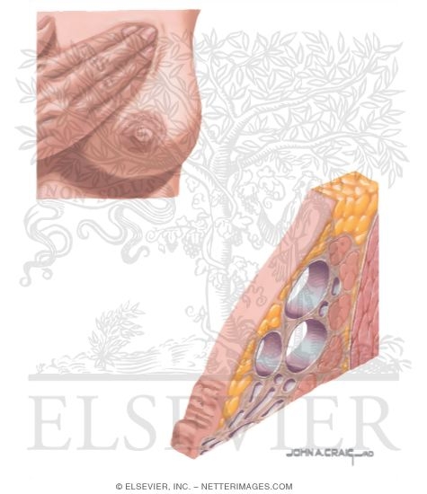 Fibrocystic Disease