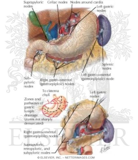Watermarked preview of labeled image: Lymph Vessels and Nodes of Stomach
Lymphatic Drainage of Stomach
