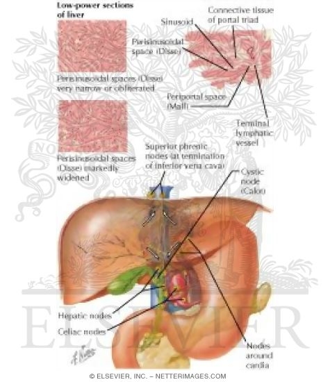 Watermarked preview of labeled image: Lymph Vessels and Nodes of Liver
Lymphatic Drainage of Liver and Bile Tract
