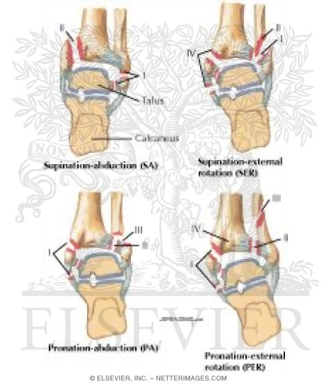 Classification of Ankle Fractures