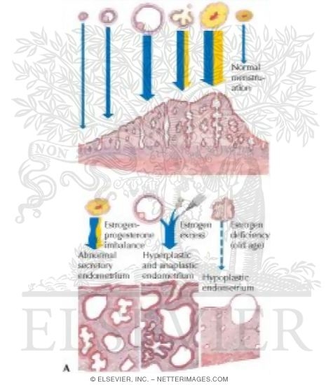Dysfunctiobal Uterine Bleeding