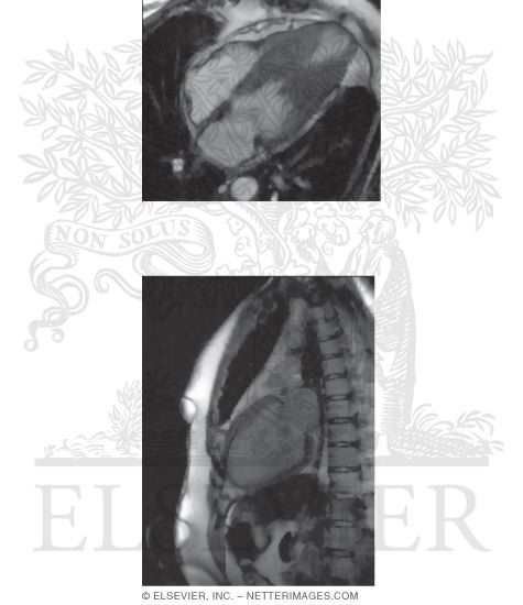 Watermarked preview of unlabeled image: Cardiac Magnetic Resonance Imaging (MRI)