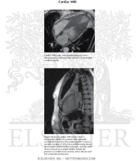Watermarked preview of labeled image: Cardiac Magnetic Resonance Imaging (MRI)
