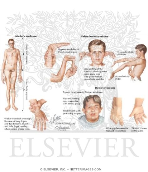 Watermarked preview of labeled image: Physical Examination: General Inspection
