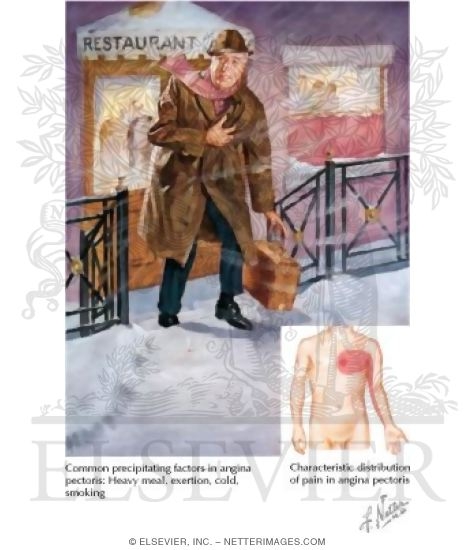 Watermarked preview of labeled image: Angina Pectoris