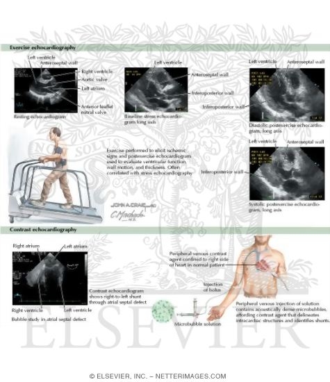 Watermarked preview of labeled image: Exercise and Contrast Echocardiography